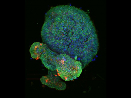 SDCM – Mikroskopie organoidů